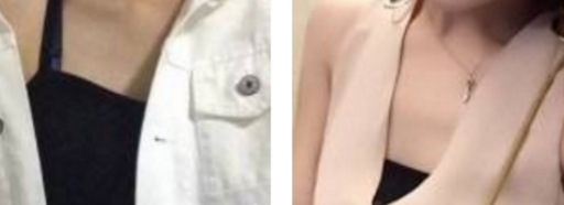 用超 声 波自体脂肪丰胸结束le平胸ー族 用超 声 波自体脂肪丰胸结束le平胸ー族