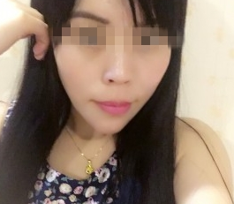 不开刀下巴延长术真人记录 不开刀下巴延长术真人记录