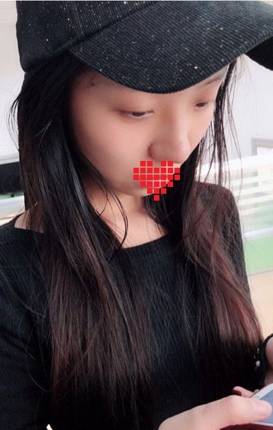 做个超声波去眼袋,真的是标准的美人脸865 做个超声波去眼袋,真的是标准的美人脸865