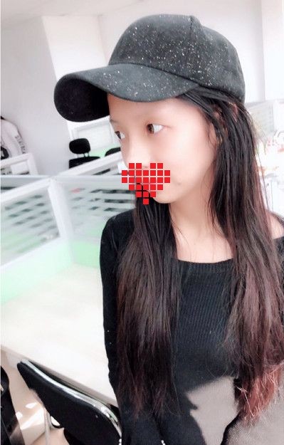 做个超声波去眼袋,真的是标准的美人脸865 做个超声波去眼袋,真的是标准的美人脸865