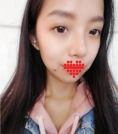 做个超声波去眼袋,真的是标准的美人脸865 做个超声波去眼袋,真的是标准的美人脸865