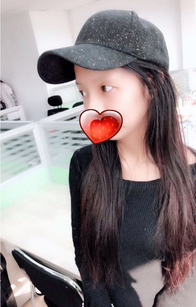 超声波去眼袋年轻漂亮就这么简单516 超声波去眼袋年轻漂亮就这么简单516