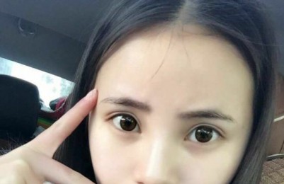 快速的去除顽固得眼袋258 快速的去除顽固得眼袋258