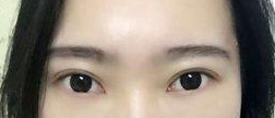 快速的去除顽固得眼袋258 快速的去除顽固得眼袋258