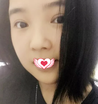 超声 波双yǎn皮