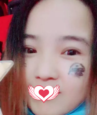 超声 波双yǎn皮