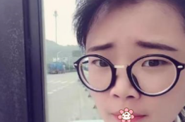 超声波双眼皮技术怎么样?女汉子来见证啦!324 超声波双眼皮技术怎么样?女汉子来见证啦!324