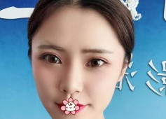 超声波双眼皮技术怎么样?女汉子来见证啦!324 超声波双眼皮技术怎么样?女汉子来见证啦!324