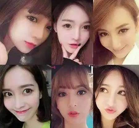 眼皮比较厚适合什么类型的双眼皮手术?918 眼皮比较厚适合什么类型的双眼皮手术?918