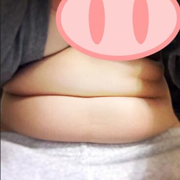 超声波减肥告诉你如何扼杀万病之源?310 超声波减肥告诉你如何扼杀万病之源?310
