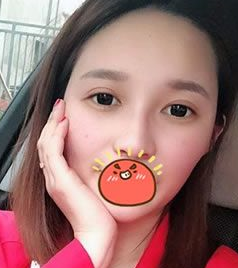 超声 波双yǎn皮