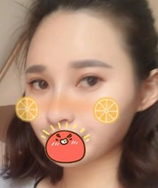 超声 波双yǎn皮