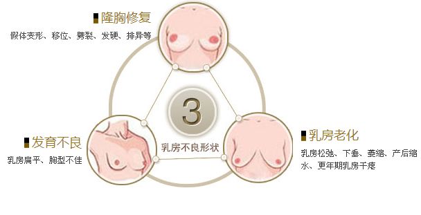 shì什么条件让超 声 波自体脂肪丰胸能ー次成型？