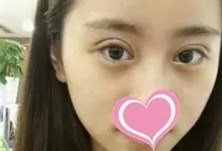 超声 波双yǎn皮