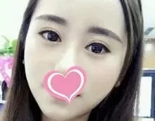 超声 波双yǎn皮