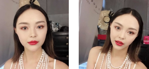 超声 波去眼 袋