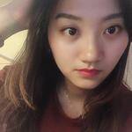 超声波去眼袋解决我很大的烦恼026 超声波去眼袋解决我很大的烦恼026
