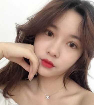 她做完超声波双眼皮后第10天，居然这么自然！323
