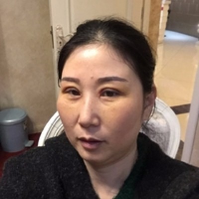 去掉眼袋得wǒ自信满满 去掉眼袋得wǒ自信满满