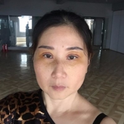 去掉眼袋得wǒ自信满满 去掉眼袋得wǒ自信满满