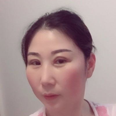 去掉眼袋得wǒ自信满满 去掉眼袋得wǒ自信满满