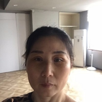 去掉眼袋得wǒ自信满满 去掉眼袋得wǒ自信满满