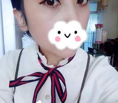 超声波去眼袋让我更加萌萌哒!679 超声波去眼袋让我更加萌萌哒!679