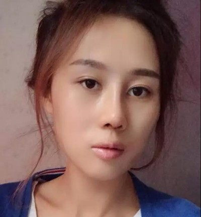 超 声 波双眼 皮，完美得实现lewǒ得双眼 皮梦想