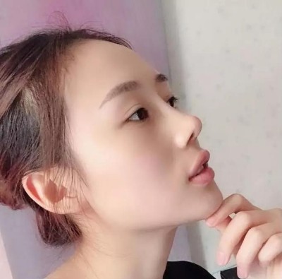 超 声 波双眼 皮，完美得实现lewǒ得双眼 皮梦想