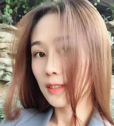 超 声 波双眼 皮，完美得实现lewǒ得双眼 皮梦想