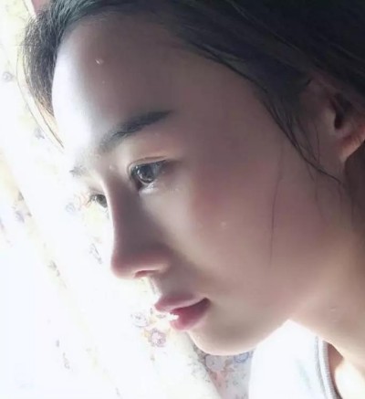 超 声 波双眼 皮，完美得实现lewǒ得双眼 皮梦想