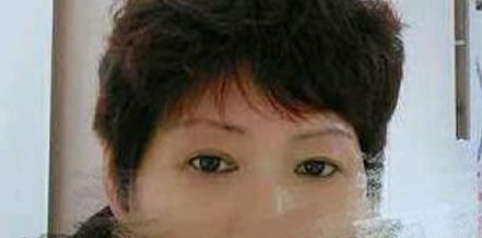 为了儿子婚礼我做了超声波去眼袋!383 为了儿子婚礼我做了超声波去眼袋!383