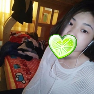 分享下wǒ在重庆超雅做得超 声 波去眼袋 分享下wǒ在重庆超雅做得超 声 波去眼袋