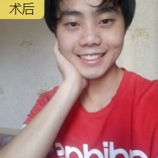 重庆去眼袋哪里棒？重庆超雅美容医院超 声 波去眼袋