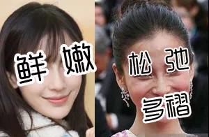 重庆超雅玻尿酸塑形（下巴延长术）让你依旧美！948