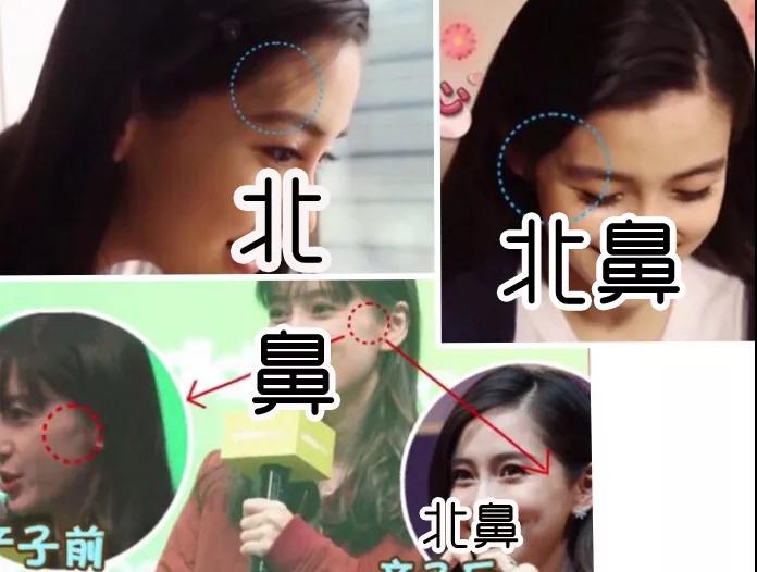 重庆超雅玻尿酸塑形（下巴延长术）让你依旧美！948