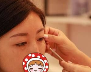 重庆去眼袋手术美容整形医院我选超雅!397 重庆去眼袋手术美容整形医院我选超雅!397