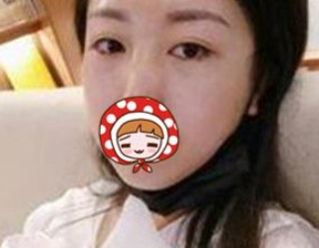 重庆去眼袋手术美容整形医院我选超雅!397 重庆去眼袋手术美容整形医院我选超雅!397