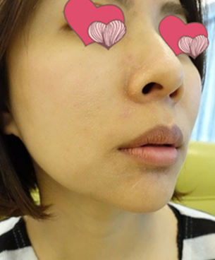 在重庆超雅做le超级微拉美,只因宝妈不服老 在重庆超雅做le超级微拉美,只因宝妈不服老