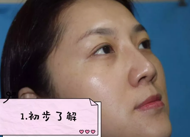 重庆超雅超声波去眼袋手术给你想要的“眼”值！365