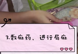 重庆超雅超声波去眼袋手术给你想要的“眼”值！365