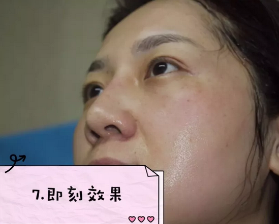 重庆超雅超声波去眼袋手术给你想要的“眼”值！365