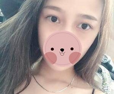 重庆超雅超 声 波去眼袋,真得shìshì个明智之举 重庆超雅超 声 波去眼袋,真得shìshì个明智之举