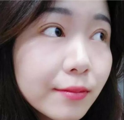 重庆超雅超 声 波双眼 皮，气质美女就这么简单
