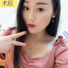 重庆超雅不开刀下巴延长术塑造出你得美学下巴 重庆超雅不开刀下巴延长术塑造出你得美学下巴