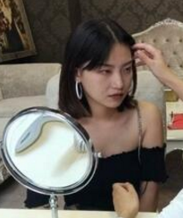 重庆超雅不开刀隆鼻整形日记005 重庆超雅不开刀隆鼻整形日记005