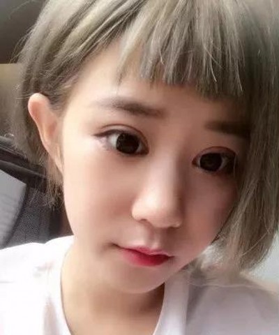 重庆超雅超声波双眼皮,再也不怕拍合照了531 重庆超雅超声波双眼皮,再也不怕拍合照了531