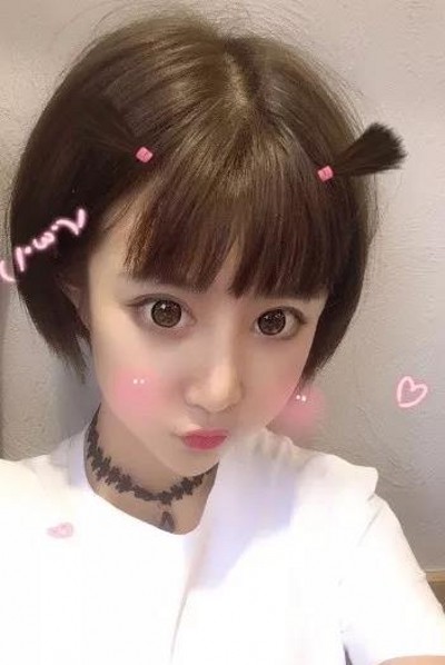重庆超雅超声波双眼皮,再也不怕拍合照了531 重庆超雅超声波双眼皮,再也不怕拍合照了531