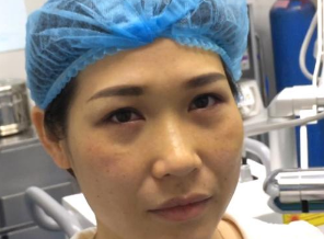 重庆超雅超声波去眼袋手术摆脱内个大眼袋!752 重庆超雅超声波去眼袋手术摆脱内个大眼袋!752