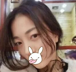 重庆超雅超声波去眼袋手术摆脱内个大眼袋!752 重庆超雅超声波去眼袋手术摆脱内个大眼袋!752